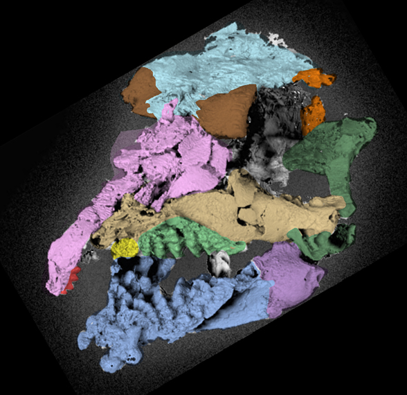 Helodus CT scan